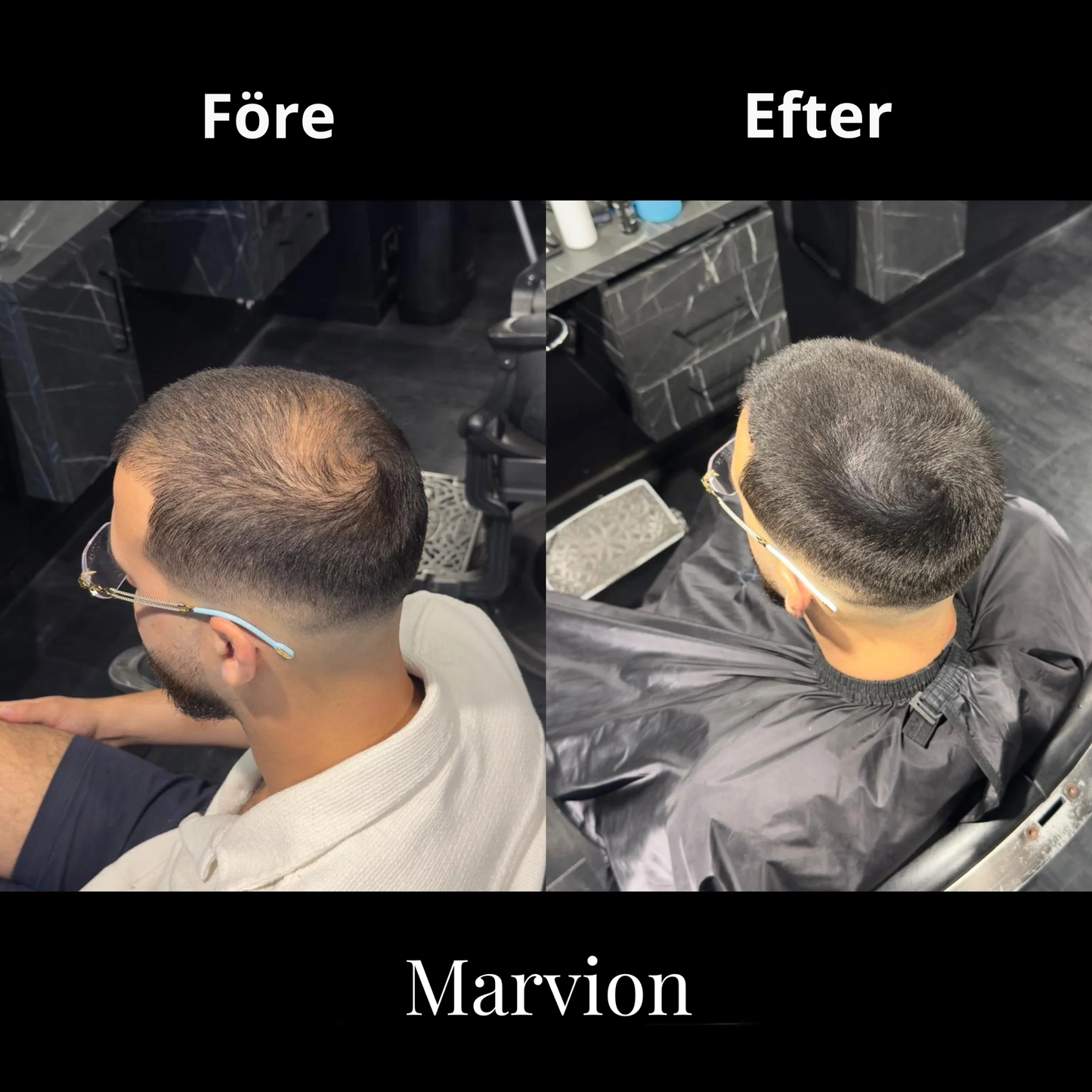 Marvion Hair Concealer